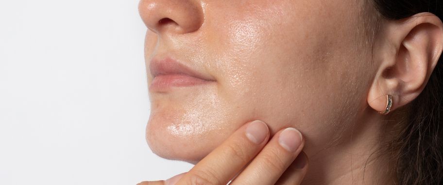 Arykuł banner - Nadmierne wydzielanie sebum &ndash; jak poradzić sobie z tym problemem?