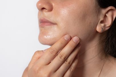 Zdjęcie artykułu - Nadmierne wydzielanie sebum &ndash; jak poradzić sobie z tym problemem?