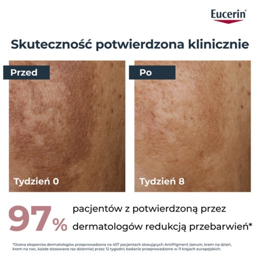 Miniaturka artykułu - #1 Eucerin Anti-Pigment Krem na dzień przeciw przebarwieniom SPF30, 50 ml