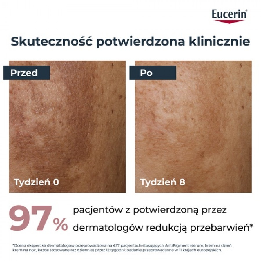Zdjęcie produktu - 2 Eucerin Anti-Pigment Krem na noc przeciw przebarwieniom, 50 ml