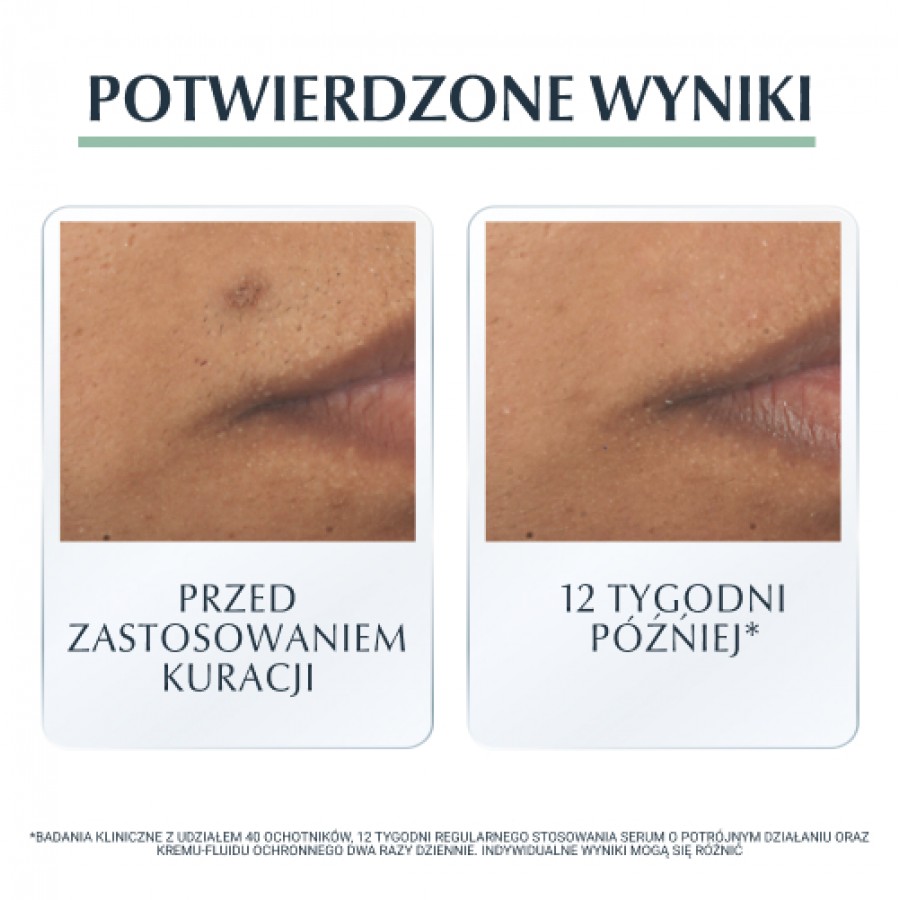 Zdjęcie produktu - 3 Eucerin DermoPure Serum o potr&oacute;jnym działaniu, 40 ml