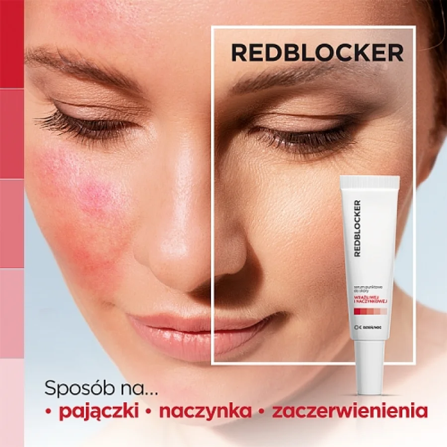 #0 – REDBLOCKER Serum punktowe, 30 ml