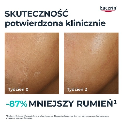 Miniaturka artykułu - #1 Eucerin DermoPure Clinical Hydra Repair Krem kojący z ceramidami, 40 ml