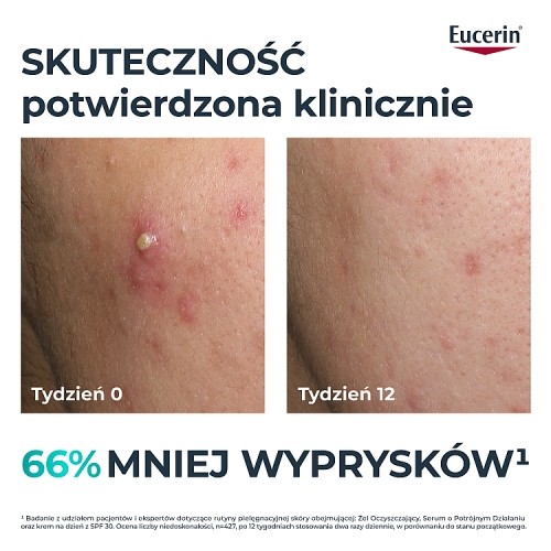 Miniaturka artykułu - #0 Eucerin DermoPure Clinical Serum na przebarwienia o potr&oacute;jnym działaniu, 40 ml