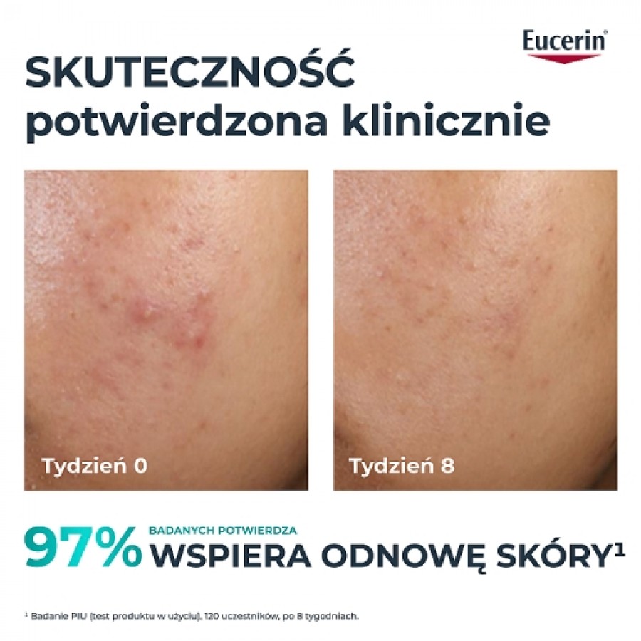 Miniaturka artykułu - #0 Eucerin DermoPure Clinical Kuracja złuszczająco-wygładzająca Kwasowy peeling na noc cera trądzikowa, 40 ml
