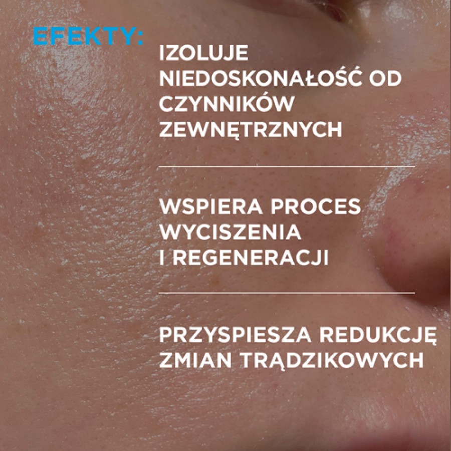 Miniaturka artykułu - #1 Idee Derm Żel punktowy na wypryski, 15 ml