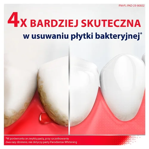 #0 – Parodontax Ultra Clean Pasta do zęb&oacute;w na krwawiące dziąsła z fluorem, 75 ml