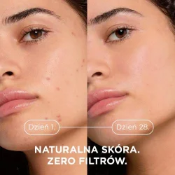 #2 – BIODERMA S&eacute;bium Kerato+ Żel-Krem Przeciwtrądzikowy, 30ml
