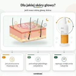 #0 – PSORISEL Emulsja do pielęgnacji sk&oacute;ry głowy u os&oacute;b z objawami łuszczycy na noc, 200ml