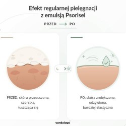 #2 – PSORISEL Emulsja do pielęgnacji sk&oacute;ry głowy u os&oacute;b z objawami łuszczycy na noc, 200ml