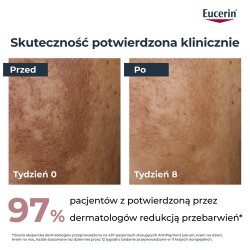 Zdjęcie produktu - #1 Eucerin Anti-Pigment Krem na dzień przeciw przebarwieniom SPF30, 50 ml