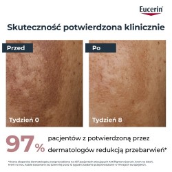 Zdjęcie produktu - #2 Eucerin Anti-Pigment Krem na noc przeciw przebarwieniom, 50 ml