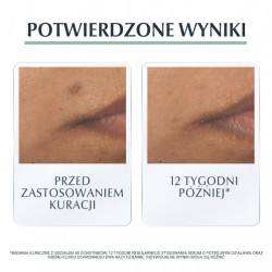 Zdjęcie produktu - #3 Eucerin DermoPure Serum o potr&oacute;jnym działaniu, 40 ml
