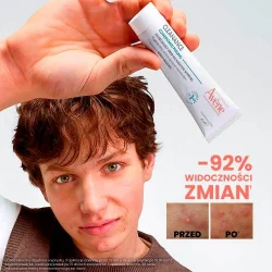 #2 – AVENE Cleanance Comedomed Peeling, 40ml