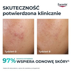 Zdjęcie produktu - #0 Eucerin DermoPure Clinical Kuracja złuszczająco-wygładzająca Kwasowy peeling na noc cera trądzikowa, 40 ml