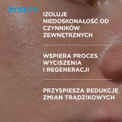 Zdjęcie produktu - #1 Idee Derm Żel punktowy na wypryski, 15 ml