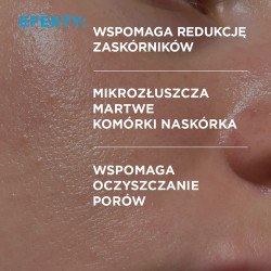 Zdjęcie produktu - #1 Idee Derm Serum zwalczające trądzik z kwasami, 30 ml