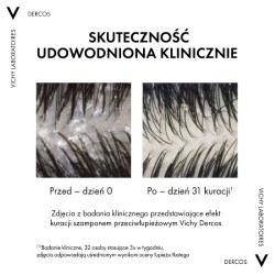 Zdjęcie produktu - #3 Vichy Dercos DS Szampon przeciwłupieżowy do włos&oacute;w normalnych i tłustych, 390 ml